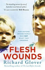 Flesh wounds / Richard Glover.